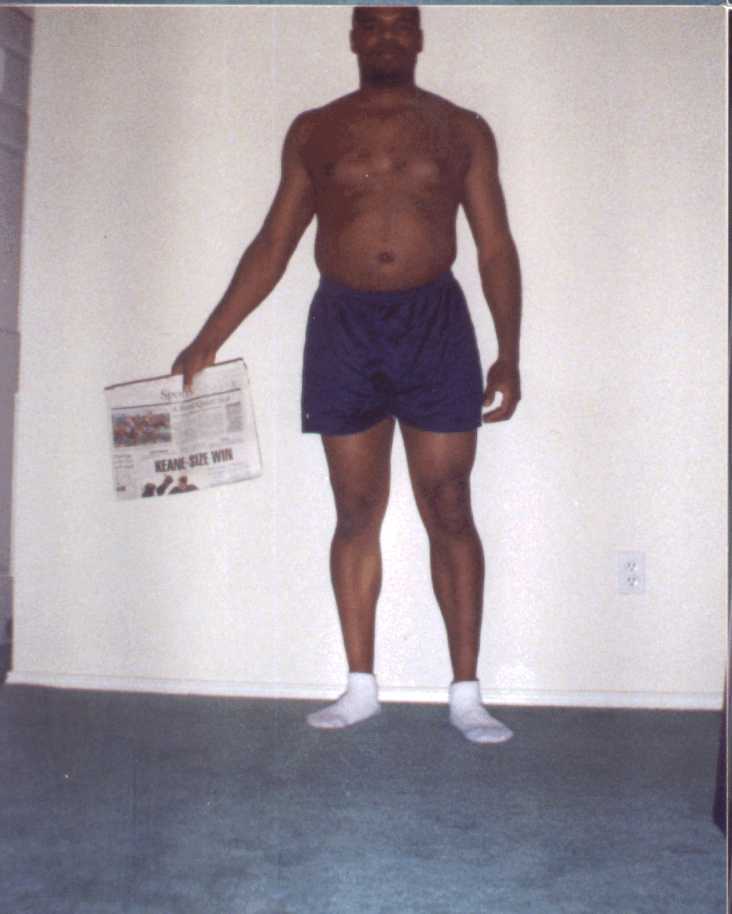 stomach.gif (867238 bytes)